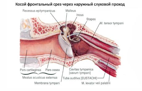 Sengatan auditori (eustachius)