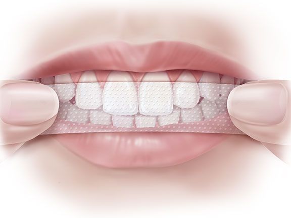 Bagaimana cara menggunakan whitening strip untuk gigi?