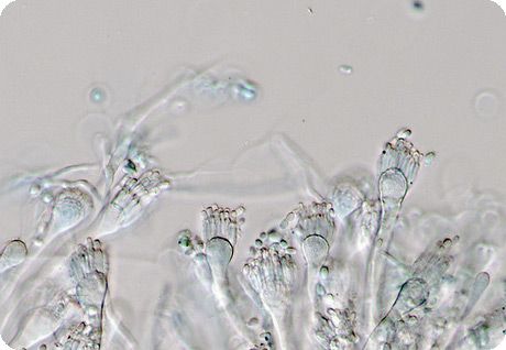 Salah satu jamur dari genus Aspergillus 