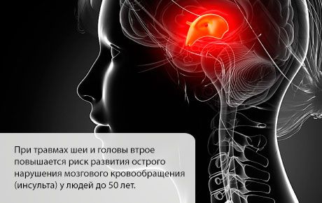 Kemungkinan stroke meningkat pada bulan-bulan pertama setelah cedera kepala atau leher