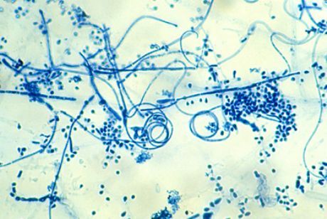 Agen penyebab epidermofitosis kaki (Trichophyton interdigitale)